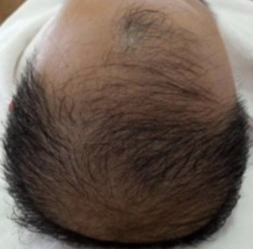 Before/After Image